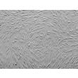 Human Mammary Fibroblasts (HMF) - Relief contrast, 100x.
