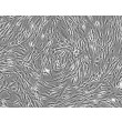 Human Mammary Fibroblasts (HMF) - Phase contrast, 100x.