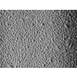 Human Prostate Epithelial Cells (HPrEpiC) - Relief contrast, 100x.
