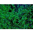 Human Prostate Fibroblasts (HPrF) - Immunostaining for Fibronectin, 100x.