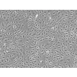 Human Prostate Microvascular Endothelial Cells (HPrMEC) - Phase contrast, 100x.
