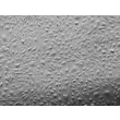 Human Prostate Microvascular Endothelial Cells (HPrMEC) - Relief contrast, 100x.
