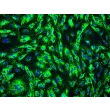 Human Prostate Microvascular Endothelial Cells (HPrMEC) - Immunostaining for vWF, 200x.
