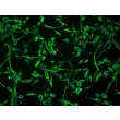 Human Schwann Cells (HSC) - Immunostaining for S100-β, 200x.
