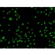 Human Sertoli Cells (HSerC)-Immunostaining for GATA-4, 200x.
