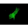 Mouse Cardiac Myocytes (MCM) – Immunostaining for Sarcomeric alpha-Actinin (Boster, Cat #MA1104)

