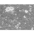 Mouse Cardiac Myocytes from CD1 (MCM) - Phase contrast, 200x.
