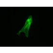 Mouse Cardiac Myocytes from CD1 (MCM) – Immunostaining for Tropomyosin (Sigma, Cat #T9283)
