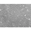 Mouse Meningeal Cells (MMenC) - Phase contrast, 100x.
