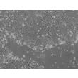 hESC growth in STEMium – phase contrast, 100x.
