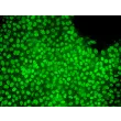 hESC growth in STEMium – Immunostaining for NANOG (green), 200x.
