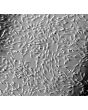 Human Thyroid Fibroblasts (HThF) - Relief contrast, 100x.
