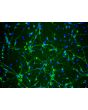 Rat Neurons-striatal (RN-s) - Immunostaining for β-Tubulin III, 200x.
