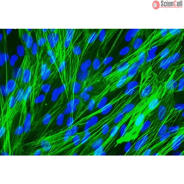 人类肺动脉平滑肌细胞 [HPASMC] - α-SMA 的免疫染色，400倍