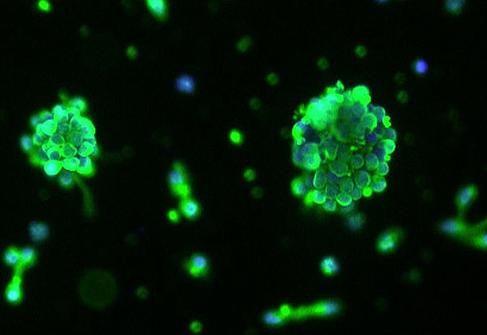 The Advantages and Difficulties of Working with Primary Cells