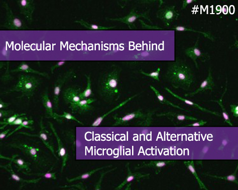 Novel Molecular Insights into Classical and Alternative Activation States of Microglia
