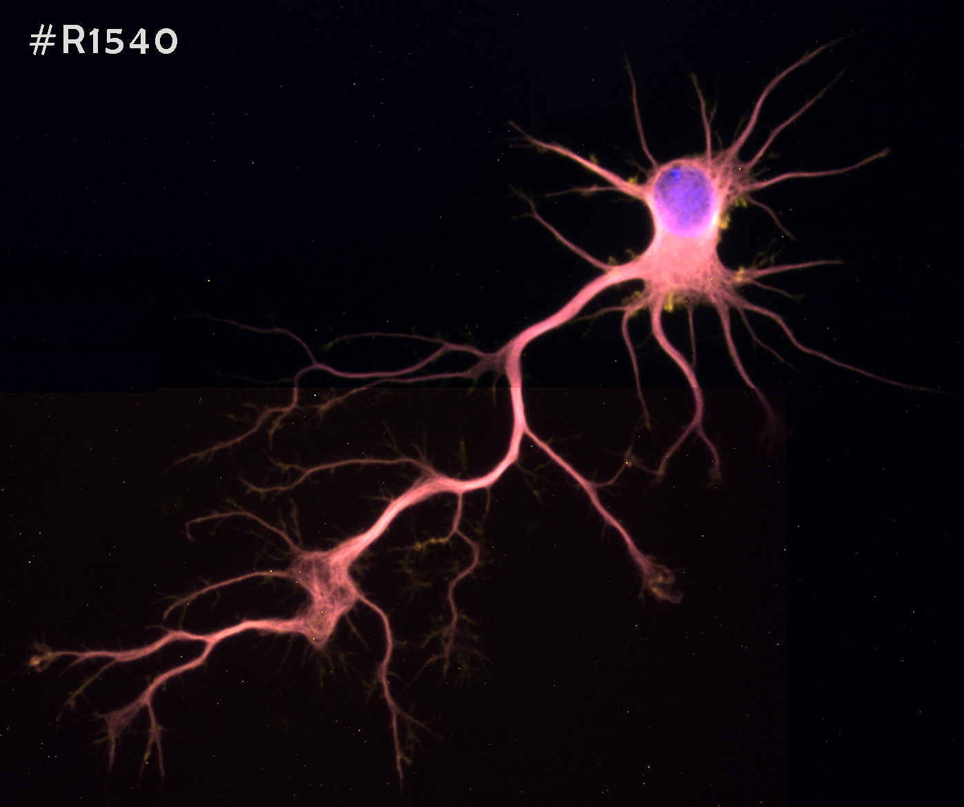 Neurological Disease Therapy through Regulation of Reactive Oxygen Species Levels