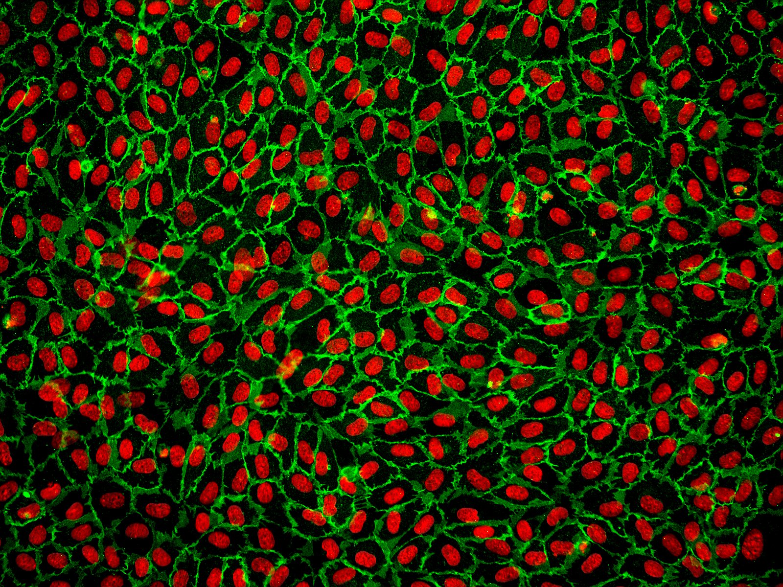 ScienCell a Unique Provider of Primary Schwann Cells Worldwide