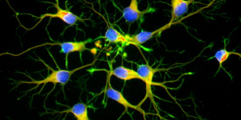 Primary Neurons vs Neuronal Cell Lines