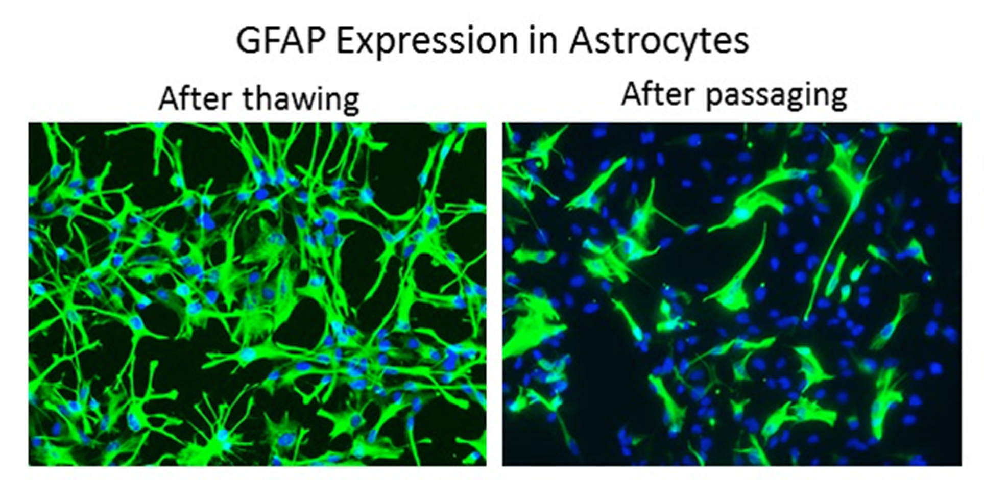 GFAP Expression in Astrocytes