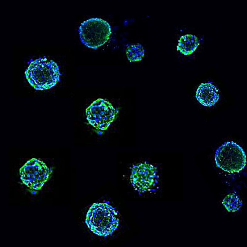 Gain New Biological Insights with Ready-To-Use Spheroids