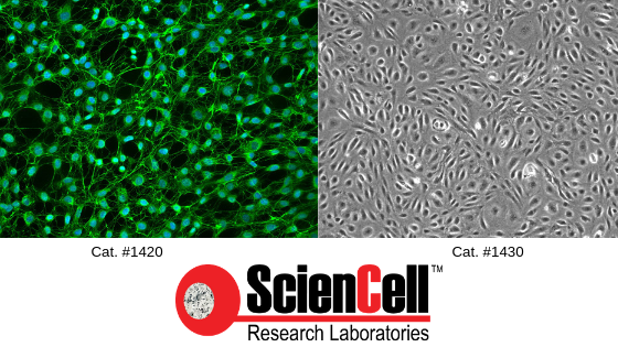 Dural Cells: Key Players in Migraine Development