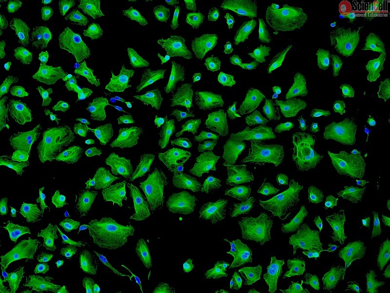 Human Pulmonary Alveolar Epithelial Cells (HPAEpiC) - Immunostaining for CK-18, 100x.