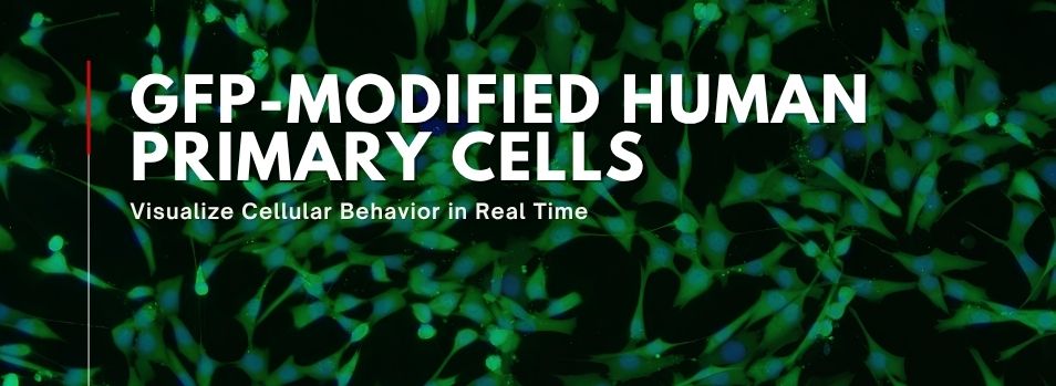 GFP-Modified Human Primary Cells GFP-Modified Human Primary Cells