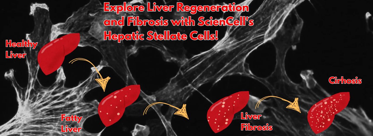 Explore Liver Regeneration and Fibrosis with ScienCell's Hepatic Stellate Cells