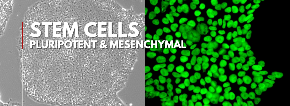 Stems Cells - Pluripotent & Mesenchymal Stem Cell Stem - Pluripotent & Mesenchymal